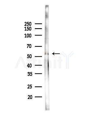 GABA A Receptor beta 3 Antibody - Western blot analysis of lysates from HUVEC cells(starvation,24h treatment), using GABA A Receptor beta 3 Antibody at 1/1000 dilution.