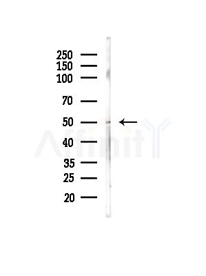 GABA A Receptor beta 3 Antibody - Western blot analysis of lysates from Mouse testis, using GABA A Receptor beta 3 Antibody at 1/1000 dilution.