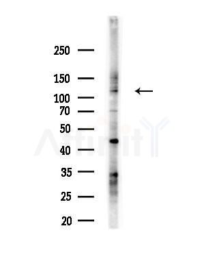 Slingshot homolog 1 Antibody - Western blot analysis of lysates from LoVo cells(heat-shock, 45min treatment), using Slingshot homolog 1 Antibody at 1/1000 dilution.
