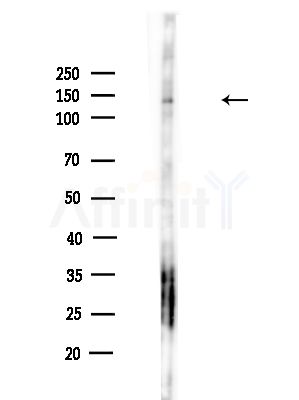 PLVAP Antibody - Western blot analysis of lysates from HUVEC cells(UV,30min treatment), using PLVAP Antibody at 1/1000 dilution.