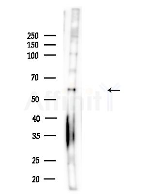 PLVAP Antibody - Western blot analysis of lysates from Rat lung, using PLVAP Antibody at 1/1000 dilution.