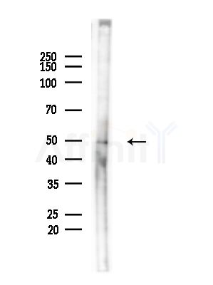 PLVAP Antibody - Western blot analysis of lysates from Mouse brain, using PLVAP Antibody at 1/1000 dilution.