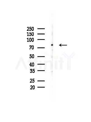 MUM1 Antibody - Western blot analysis of lysates from Mouse testis, using MUM1 Antibody at 1/1000 dilution.