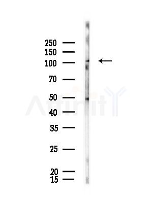 PDE11A Antibody - Western blot analysis of lysates from Rat brain, using PDE11A Antibody at 1/1000 dilution.
