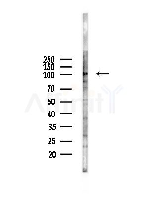PDE11A Antibody - Western blot analysis of lysates from A375 cells(starvation,24h treatment), using PDE11A Antibody at 1/1000 dilution.