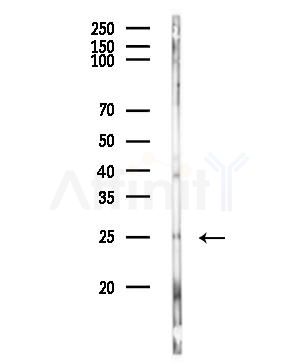 FKBP25 Antibody - Western blot analysis of lysates from Mouse lung, using FKBP25 Antibody at 1/1000 dilution.