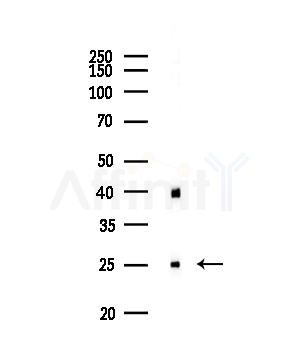 FKBP25 Antibody - Western blot analysis of lysates from PC12 cells(UV,30min treatment), using FKBP25 Antibody at 1/1000 dilution.