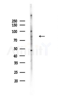 iASPP Antibody - Western blot analysis of lysates from COLO205 cells(UV,30min treatment), using iASPP Antibody at 1/1000 dilution.