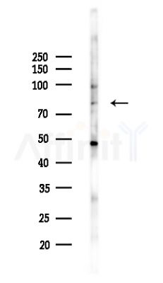iASPP Antibody - Western blot analysis of lysates from HepG2 cells(LPS,4h treatment), using iASPP Antibody at 1/1000 dilution.