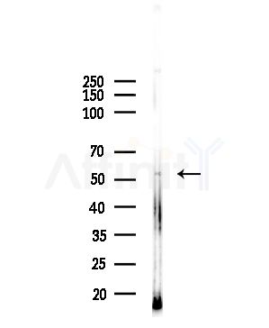 OLFM4 Antibody - Western blot analysis of lysates from HUVEC cells(UV,30min treatment), using OLFM4 Antibody at 1/1000 dilution.