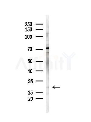 Loricrin Antibody - Western blot analysis of lysates from Mouse testis, using Loricrin Antibody at 1/1000 dilution.