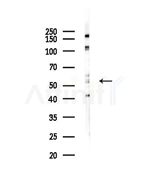 TOM1L2 Antibody - Western blot analysis of lysates from Hela cells(starvation,24h treatment), using TOM1L2 Antibody at 1/1000 dilution.