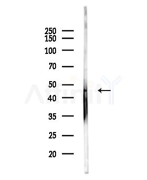 START domain containing 7 Antibody - Western blot analysis of lysates from Hela cells(starvation,24h treatment), using START domain containing 7 Antibody at 1/1000 dilution.