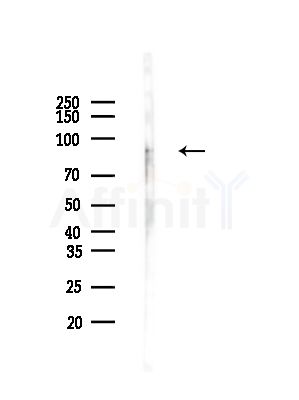 ECM2 Antibody - Western blot analysis of lysates from HepG2 cells(LPS, 4h treatment), using ECM2 Antibody at 1/1000 dilution.