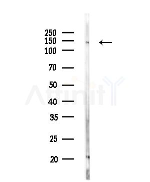 SALL1 Antibody - Western blot analysis of lysates from Rat testis, using SALL1 Antibody at 1/1000 dilution.