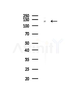 SALL1 Antibody - Western blot analysis of lysates from Hela cells(starvation,24h treatment), using SALL1 Antibody at 1/1000 dilution.