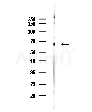 T Plastin Antibody - Western blot analysis of lysates from Hela cells(starvation,24h treatment), using T Plastin Antibody at 1/1000 dilution.