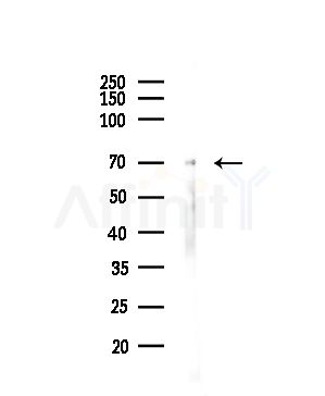 T Plastin Antibody - Western blot analysis of lysates from HUVEC cells(UV,30min treatment), using T Plastin Antibody at 1/1000 dilution.