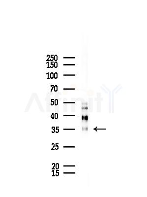 CLCA3 Antibody - Western blot analysis of lysates from Mouse lung, using CLCA3 Antibody at 1/1000 dilution.