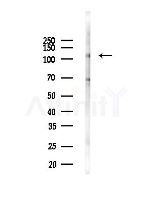 HLTF Antibody - Western blot analysis of lysates from COLO205 cells(heat-shock,45min treatment), using HLTF Antibody at 1/1000 dilution.