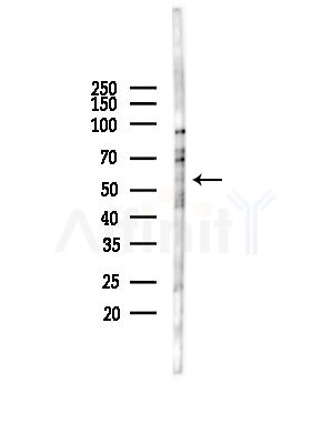 Lysyl tRNA synthetase Antibody - Western blot analysis of lysates from COLO205 cells(UV,30min treatment), using Lysyl tRNA synthetase Antibody at 1/1000 dilution.