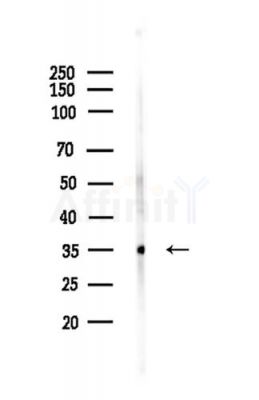 TCF21 Antibody - Western blot analysis of lysates from LoVo cells(heat-shock,45min treatment), using TCF21 Antibody at 1/1000 dilution.