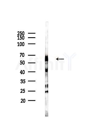 KCNK10 Antibody - Western blot analysis of lysates from LoVo cells(heat-shock,45min treatment), using KCNK10 Antibody at 1/1000 dilution.