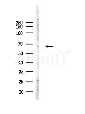 LAP1 Antibody - Western blot analysis of lysates from A375 cells(LPS, 4h treatment), using LAP1 Antibody at 1/1000 dilution.