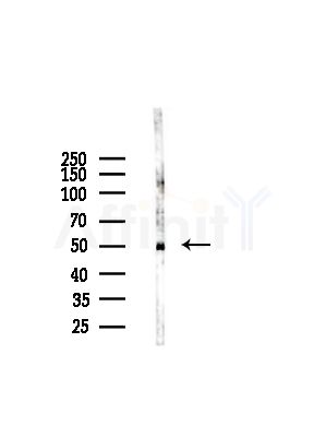 Rapsyn Antibody - Western blot analysis of lysates from A375 cells(starvation,24h treatment), using Rapsyn Antibody at 1/1000 dilution.