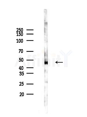 Rapsyn Antibody - Western blot analysis of lysates from HepG2 cells(LPS, 4h treatment), using Rapsyn Antibody at 1/1000 dilution.