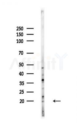 FLJ42280 Antibody - Western blot analysis of lysates from A375 cells(heat-shock,45min treatment), using FLJ42280 Antibody at 1/1000 dilution.