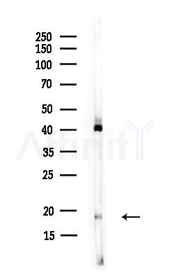 FLJ42280 Antibody - Western blot analysis of lysates from Rat liver, using FLJ42280 Antibody at 1/1000 dilution.