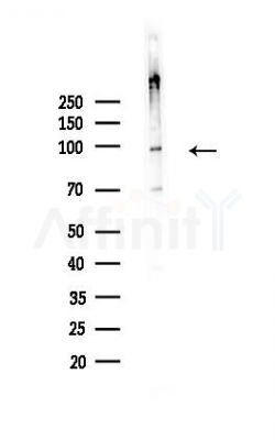 SLFN11 Antibody - Western blot analysis of lysates from A375 cells(heat-shock,45min treatment), using SLFN11 Antibody at 1/1000 dilution.