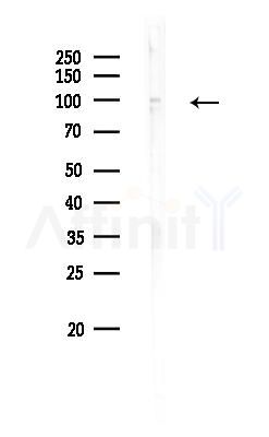 SLFN11 Antibody - Western blot analysis of lysates from Rat liver, using SLFN11 Antibody at 1/1000 dilution.