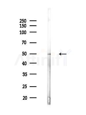 B7-H6 Antibody - Western blot analysis of lysates from COLO205 cells(heat-shock,45min treatment), using B7-H6 Antibody at 1/1000 dilution.