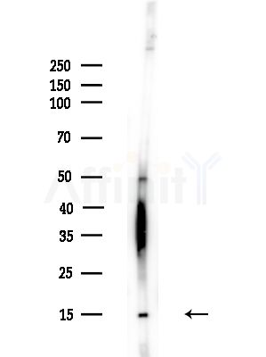 PFD6 Antibody - Western blot analysis of lysates from A375 cells(heat-shock,45min treatment), using PFD6 Antibody at 1/1000 dilution.