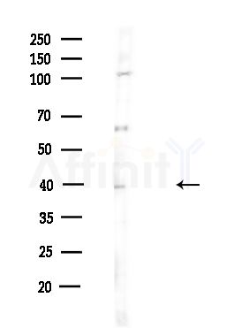 SET Antibody - Western blot analysis of lysates from HUVEC cells(UV,30min treatment), using SET Antibody at 1/1000 dilution.