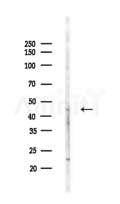 ACTR1A Antibody - Western blot analysis of lysates from COLO205 cells(UV,30min treatment), using ACTR1A Antibody at 1/1000 dilution.