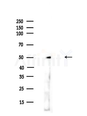 Ferredoxin Reductase Antibody - Western blot analysis of lysates from A375 cells(heat-shock,45min treatment), using Ferredoxin Reductase Antibody at 1/1000 dilution.