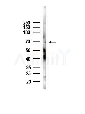 GLUT5 Antibody - Western blot analysis of lysates from Hela cells(heat-shock,45min treatment), using GLUT5 Antibody at 1/1000 dilution.
