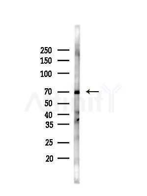 GLUT5 Antibody - Western blot analysis of lysates from Rat brain, using GLUT5 Antibody at 1/1000 dilution.