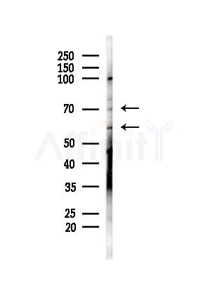 GLUT5 Antibody - Western blot analysis of lysates from Mouse testis, using GLUT5 Antibody at 1/1000 dilution.