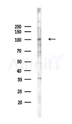 DPP6 - Catalytic domain Antibody - Western blot analysis of lysates from COLO205 cells(UV,30min treatment), using DPP6 - Catalytic domain Antibody at 1/1000 dilution.