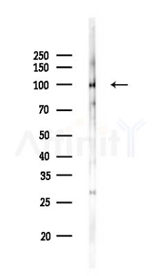 DPP6 - Catalytic domain Antibody - Western blot analysis of lysates from Rat brain, using DPP6 - Catalytic domain Antibody at 1/1000 dilution.