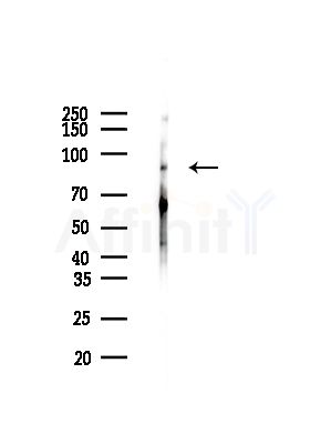 Guanylyl Cyclase alpha 2 Antibody - Western blot analysis of lysates from HepG2 cells(LPS, 4h treatment), using Guanylyl Cyclase alpha 2 Antibody at 1/1000 dilution.