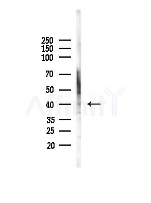 SERBP1 Antibody - Western blot analysis of lysates from Hela cells(heat-shock,45min treatment), using SERBP1 Antibody at 1/1000 dilution.