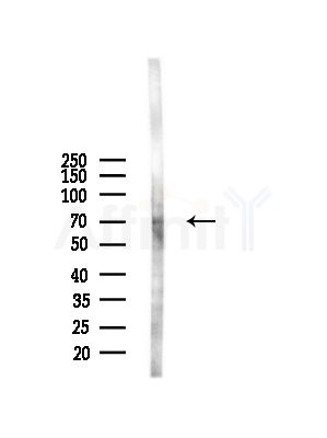 SLC40A1 Antibody - Western blot analysis of lysates from A375 cells(starvation,24h treatment), using SLC40A1 Antibody at 1/1000 dilution.