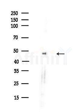 ALDH9A1 Antibody - Western blot analysis of lysates from A375 cells(heat-shock,45min treatment), using ALDH9A1 Antibody at 1/1000 dilution.