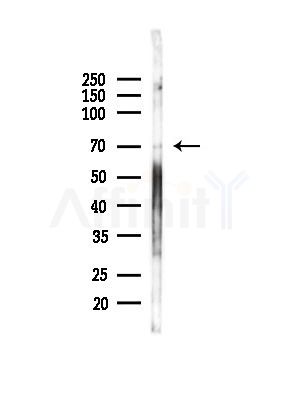 KMT5C/SUV4-20h2 Antibody - Western blot analysis of lysates from Hela cells(heat-shock,45min treatment), using KMT5C/SUV4-20h2 Antibody at 1/1000 dilution.