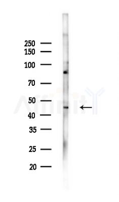 NAPE-PLD Antibody - Western blot analysis of lysates from COLO205 cells(UV,30min treatment), using NAPE-PLD Antibody at 1/1000 dilution.